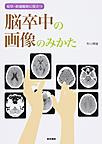 症状・経過観察に役立つ脳卒中の画像のみかた