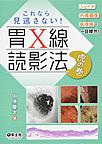 これなら見逃さない!胃X線読影法虎の巻～シェーマ+内視鏡像+病理像で一目瞭然!～