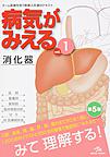 病気がみえる<vol.1>　第5版　消化器　