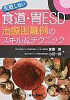 失敗しない食道・胃ESD治療困難例のスキル&テクニック