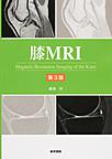 膝MRI　第3版