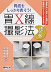 胃癌をしっかり表そう!胃X線撮影法虎の巻～撮影手技を基本から応用まで段階的にマスターできる!～