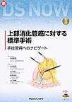 上部消化管癌に対する標準手術～手技習得へのナビゲート～(新DS NOW 1)