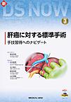 肝癌に対する標準手術～手技習得へのナビゲート～(新DS NOW 3)