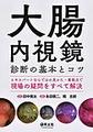 大腸内視鏡診断の基本とコツ～エキスパートならではの見かた・着眼点で現場の疑問をすべて解決～