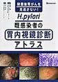 H.pylori既感染者の胃内視鏡診断アトラス～除菌後胃がんを見逃さない!～