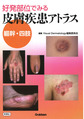 好発部位でみる皮膚疾患アトラス?幹・四肢