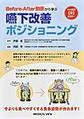 Before‐After動画から学ぶ嚥下改善ポジショニング