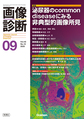画像診断<Vol.45No.10(2025-09)> 特集泌尿器のcommon diseaseにみる非典型的画像所見