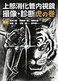上部消化管内視鏡撮像・診断虎の巻