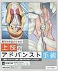 整形外科医のための上肢のアドバンスト手術